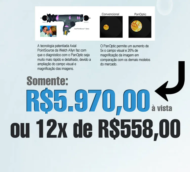 Cadeira e Coluna