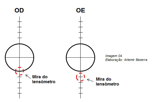 Imagem da matéria