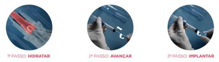 Imagem da matéria
