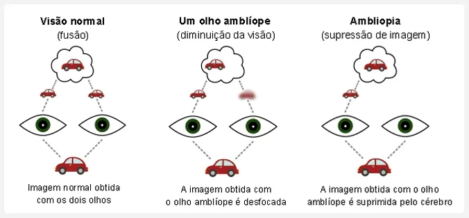 Imagem da matéria