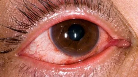 Pandemia provoca atrasos em diagnósticos e coloca em risco saúde ocular de brasileiros