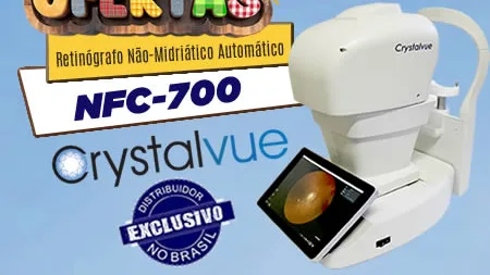 RM- Retinógrafo Não-Midriático Automático