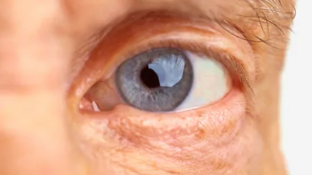 Frio prolongado pede mais cuidado com os olhos