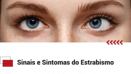 Sinais e Sintomas de Estrabismo