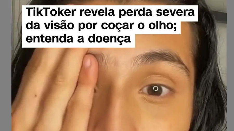 É proibido coçar os olhos!