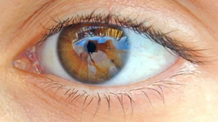 Outono pede mais cuidado com os olhos