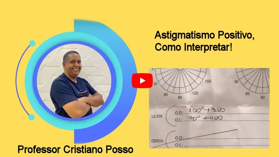 Astigmatismo Positivo! Como Interpretar!