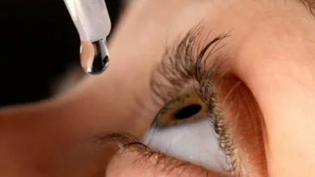 Uso excessivo de colírios pode levar a doenças oculares graves