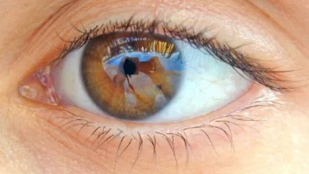 Sono ruim aumenta risco de glaucoma em até 20%,diz estudo