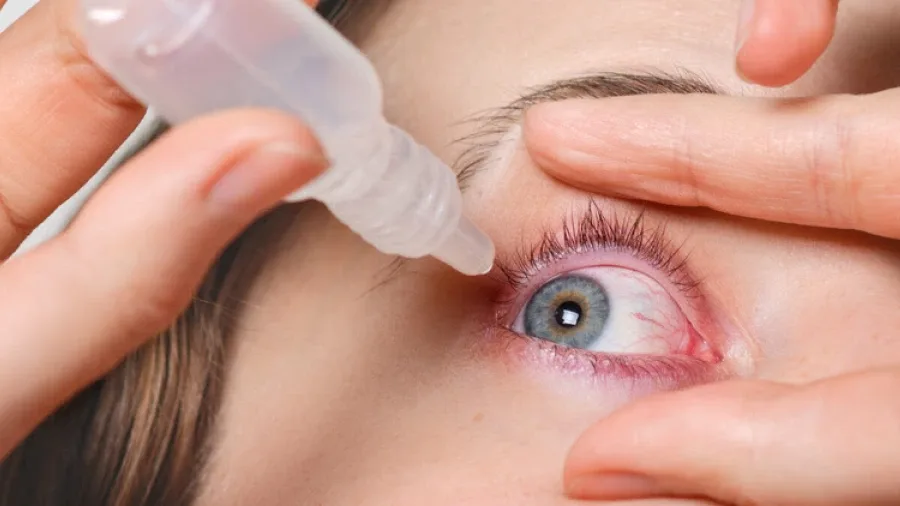Alergia ocular