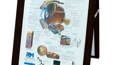 Olho Quadro com Moldura