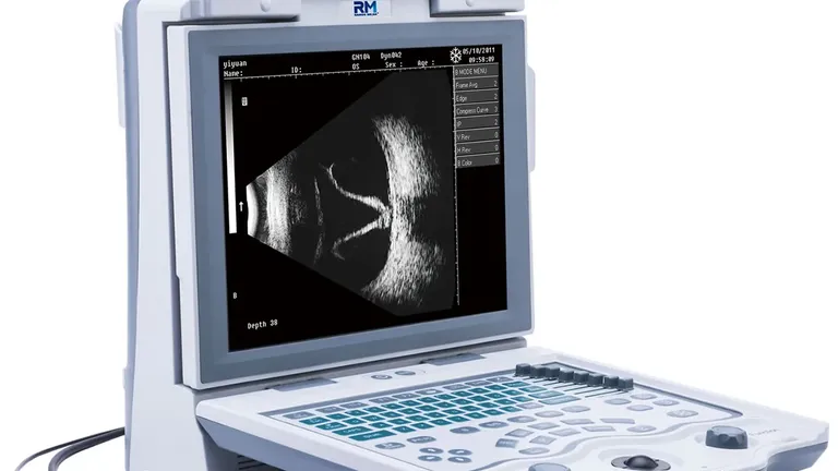 Ultrassom A/B Scan RM