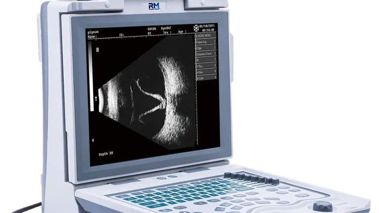 Ultrassom B Scan RM